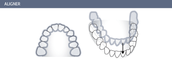 Zahnarzt für Invisalign Behandlungen, Zürich